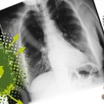 La farmacia navarra colaborará con FSFE en su campaña de recogida de radiografías con fines solidarios
