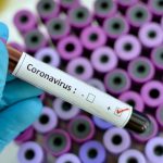 Sanidad ultima un proyecto con las CCAA para intensificar el diagnóstico del Covid19 con test rápidos